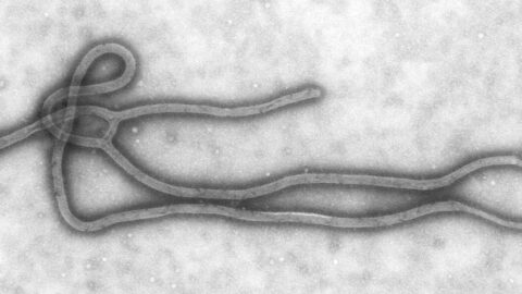 Transmission electron microscope image of an Ebola virus particle