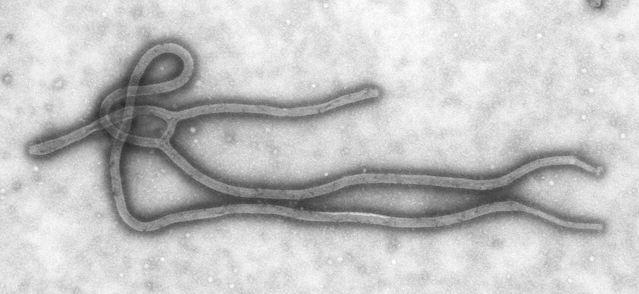 Transmission electron microscope image of an Ebola virus particle